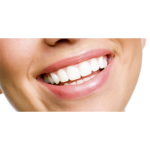 Was ist der sicherste Weg, Zähne aufzuhellen?