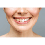 🦷 Deine Zähne sind nicht gelb-sie sind gefärbt (und meine Must-Haves, sie zu reparieren)