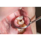 🦷 Meine Enkelin hat einen Hohlraum bekommen – hier ist das genaue Protokoll, auf das ich sie gesteckt habe